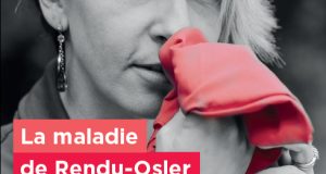 La maladie de Rendu-Osler